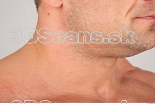 Neck texture of Gene 0003